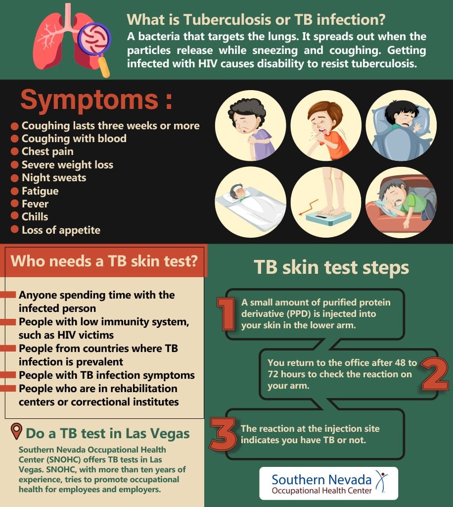 What to expect when taking a TB test? - Health Blog